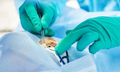 First Aid for Eye Injuries Dealing With Foreign Objects and Chemicals