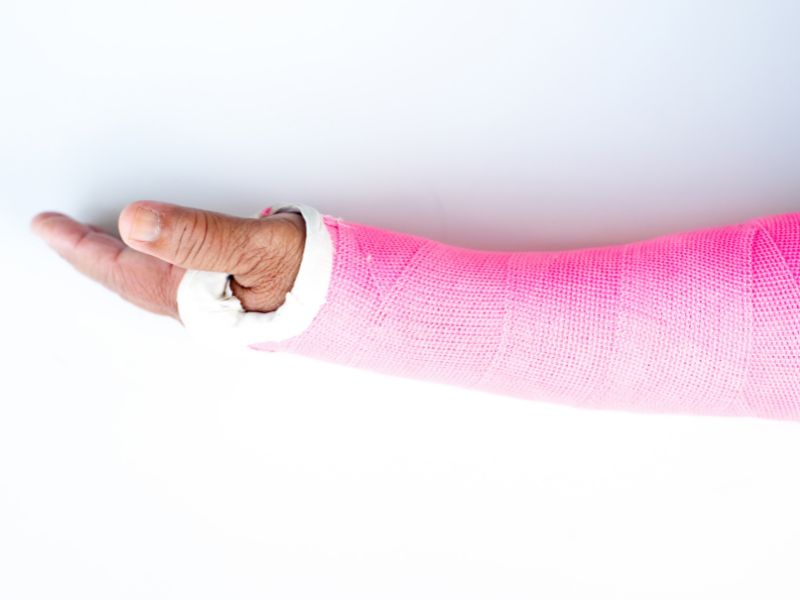 Handling Broken Bones: First Aid and Immobilization