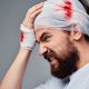 The Link Between Head Injuries and Neurodegenerative Diseases
