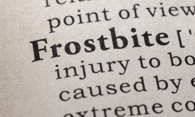 Cold-Related Injuries: First Aid Strategies for Frostbite