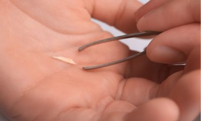 Safely Removing Splinters: First Aid for Puncture Wounds