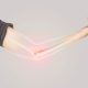 Broken Bones: What to Do Before Professional Help Arrives