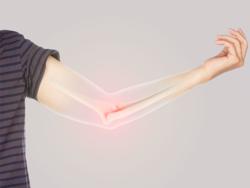 Broken Bones: What to Do Before Professional Help Arrives