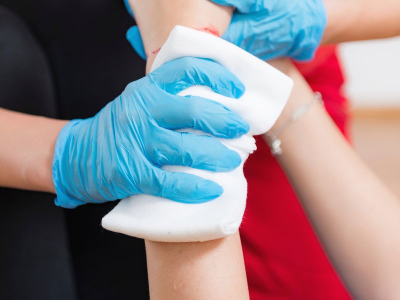 Burn First Aid: Trending Techniques for Immediate Care