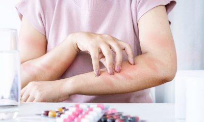 First Aid for Allergic Reactions: What Every Family Should Know