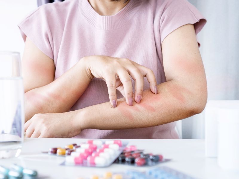 First Aid for Allergic Reactions: What Every Family Should Know