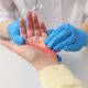 Innovative Home Care Solutions for Burn Patients