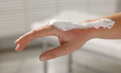 Personalized Medicine in Burn Care: A Growing Trend