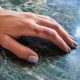 Emergency Burn Care: What to Do for Minor Burns