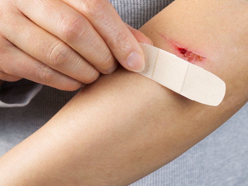 Essential First Aid Tips for Treating Minor Cuts at Home