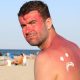 Sunburn First Aid: Quick Relief and Healing Tips