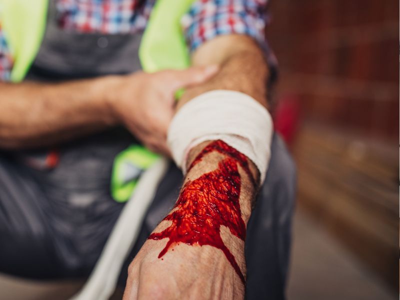 Managing Traumatic Bleeding: Advanced First Aid Protocols