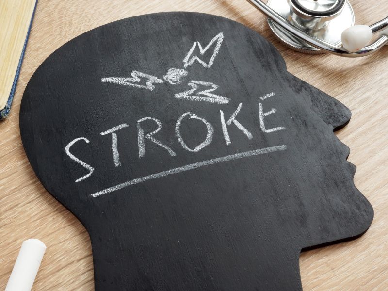 Understanding Ischemic Versus Hemorrhagic Strokes in Emergencies