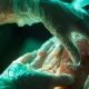 First-Degree Burn Management: Insights From Dermatological Experts