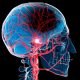 Stroke Victims and the Golden Hour of Response Time