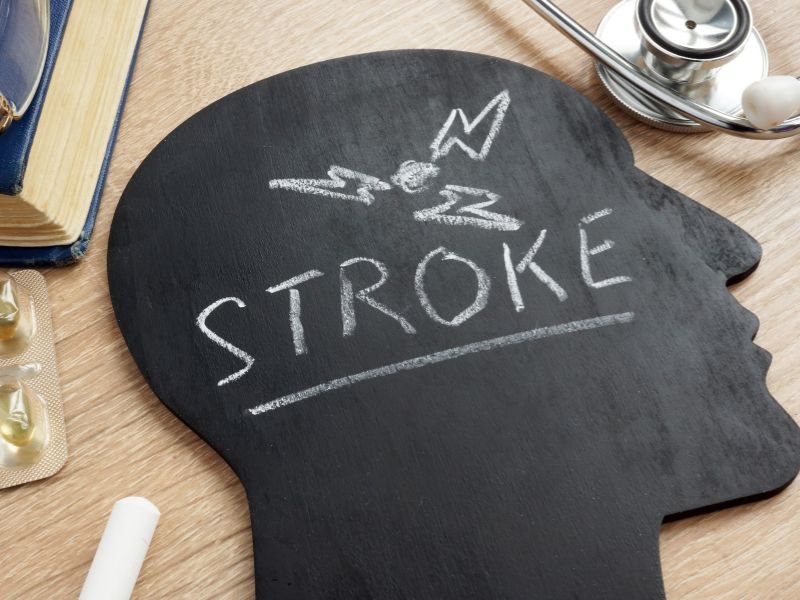 Why Time Matters Most for Stroke Victims’ Recovery