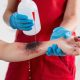 Dealing With Severe Skin Burns Before Medical Help