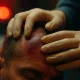 Sharp Instincts in Soft Tissue: Head Trauma First Aid