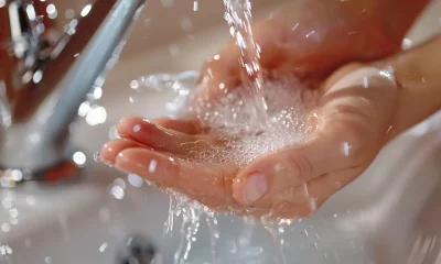 Quick First Aid Moves When Dealing With Burns