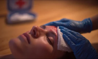 Head Injuries Aren't Always Minor — Here's How First Aid Actually Works