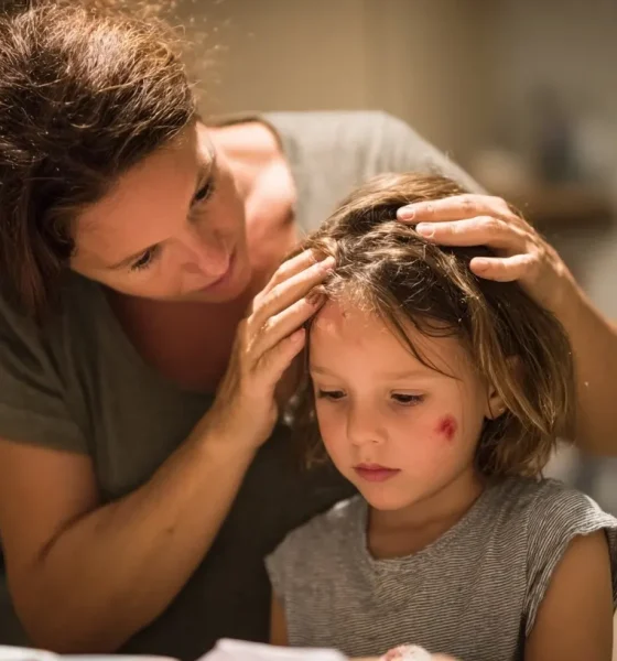 Don't Panic, But Don't Ignore It: First Aid for Minor Head Injuries Explained
