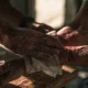 Skin Burn Emergencies? Here's Your First Aid Game Plan