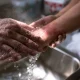 When Skin Meets Fire: First Aid Steps That Save You